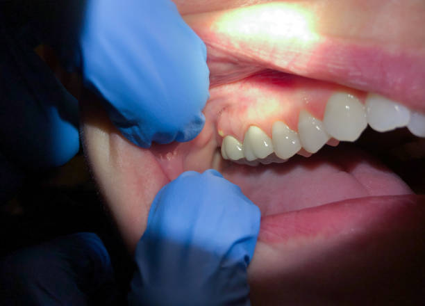 Best Cracked Tooth Emergency Dentist  in Seymour, TN